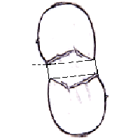 mouthoutline1.gif